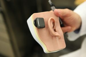 hearing loss test for baha device